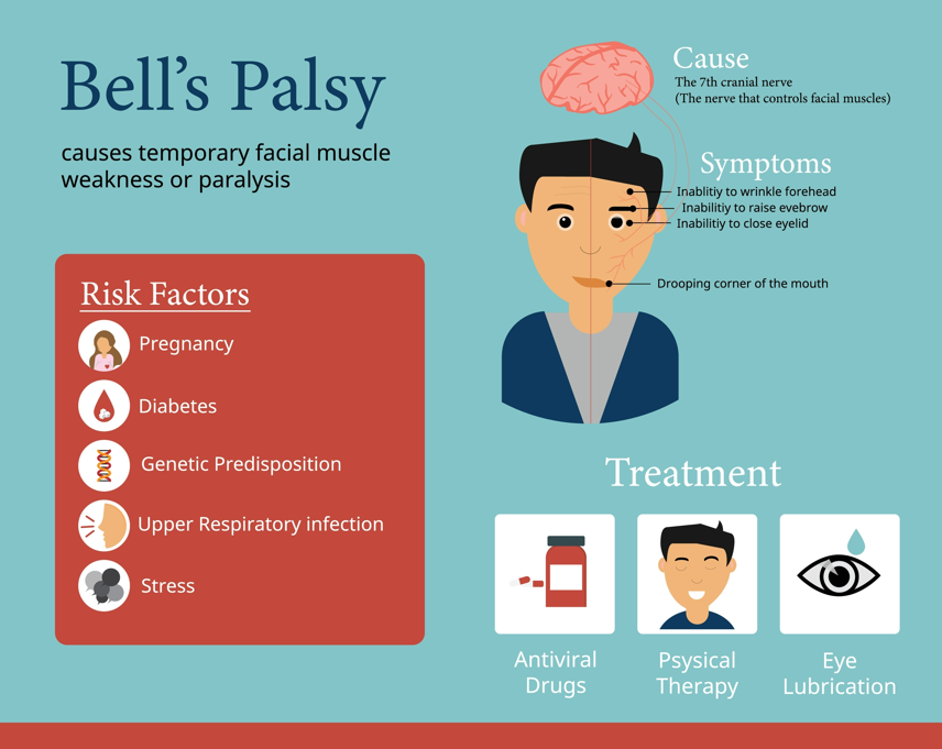 An informational graphic on Bell's Palsy detailing causes, symptoms, risk factors, and treatments.