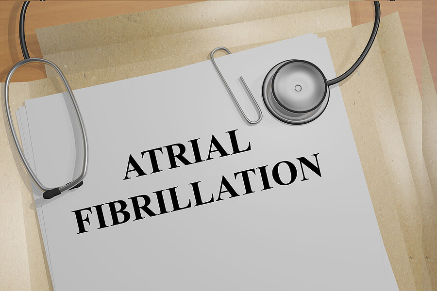 A Complete Guide to Atrial Fibrillation