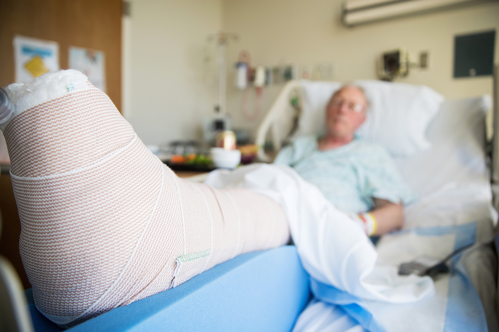 A patient with a heavily bandaged leg lies in a hospital bed